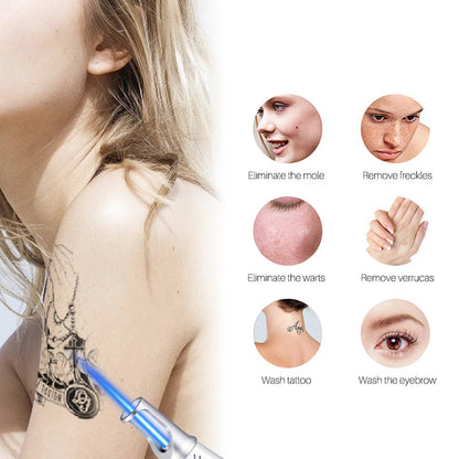 Dual Mode Blue and Red Picosecond Light Pen, Adjustable Intensity for Fading Spots, Freckles and Tattoo Ink